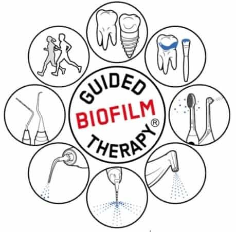 Guided Biofilm Therapy